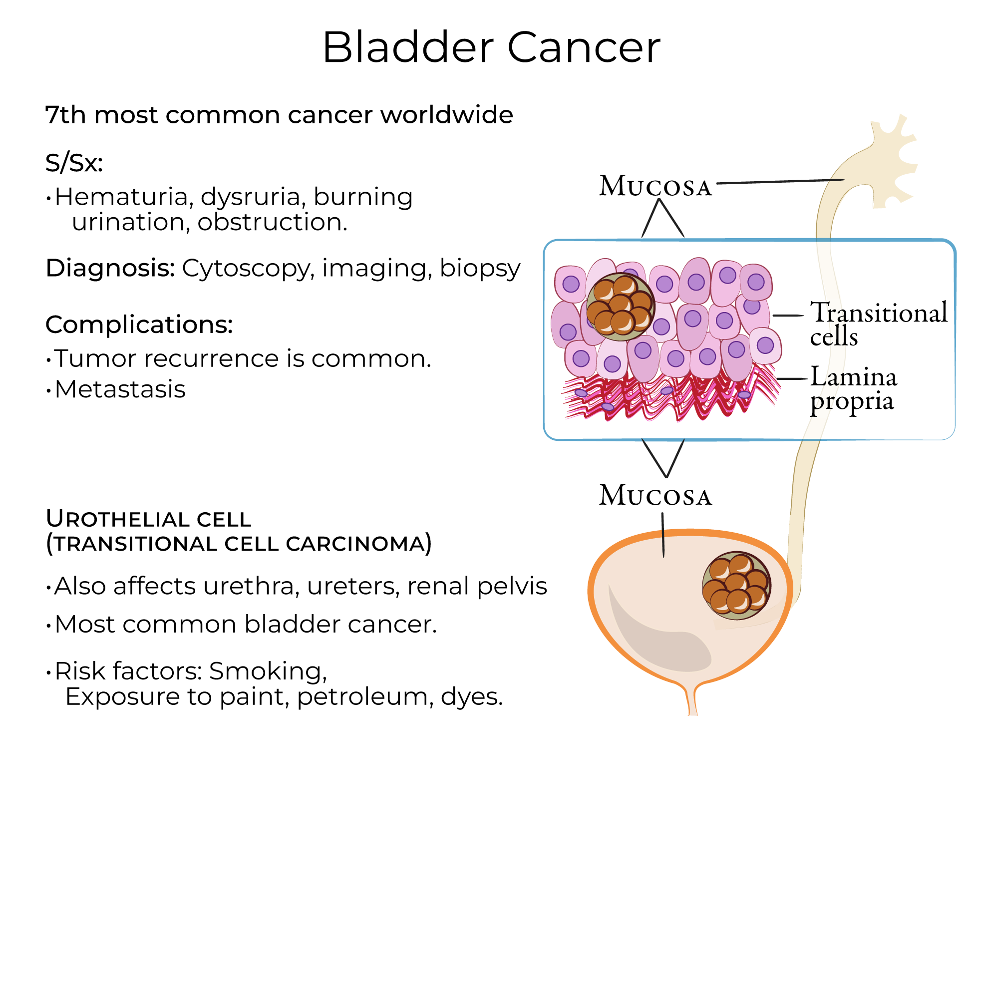 Bladder cancer
