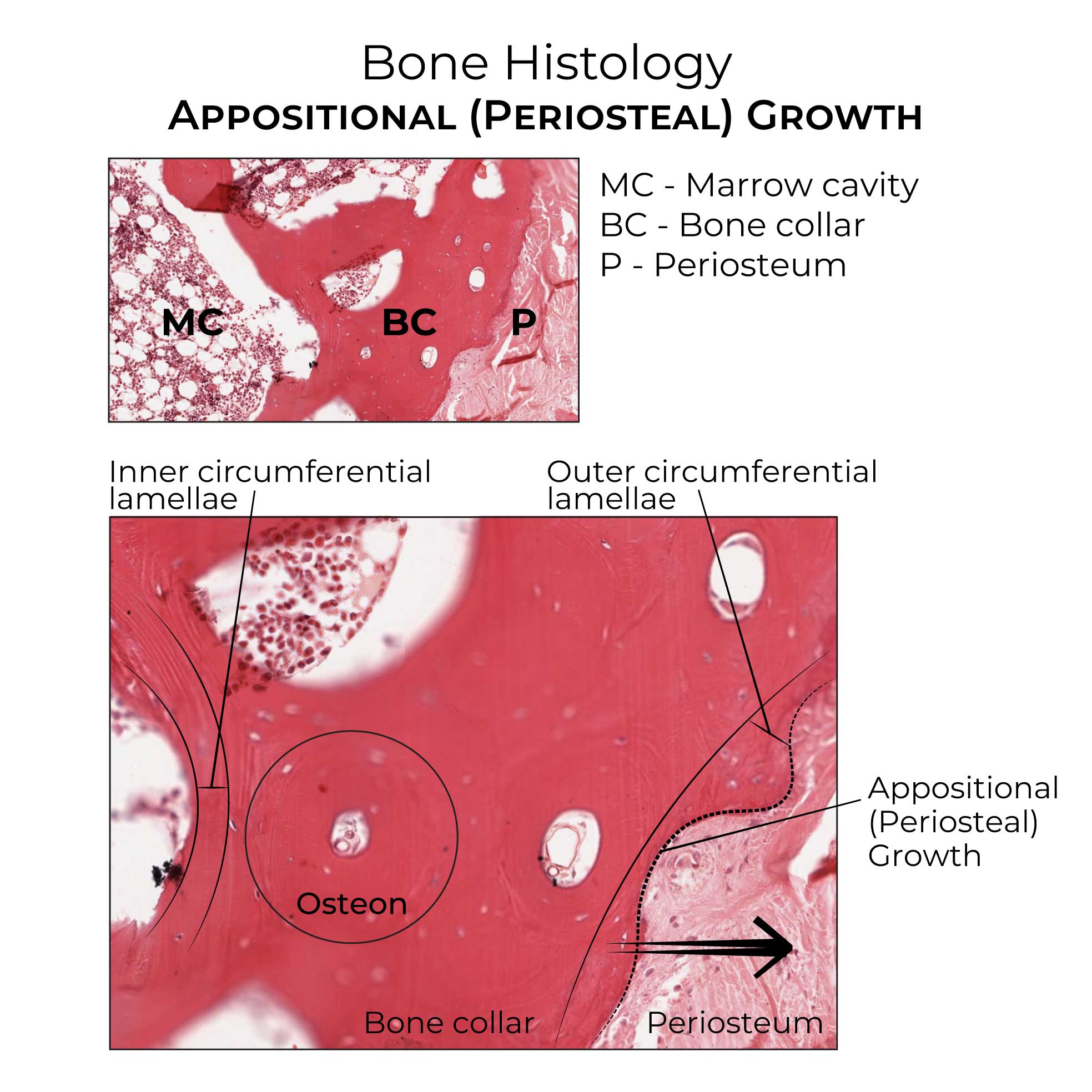 appositional bone growth. periosteal bone growth